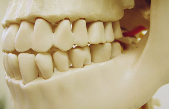 歯周病は骨の病気でもあります
